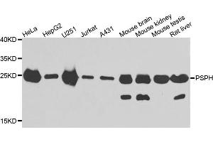 Western blot analysis of extracts of various cell lines, using PSPH antibody. (PSPH antibody)