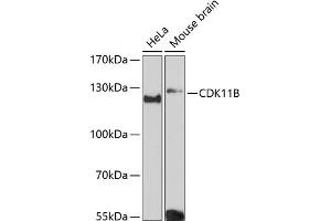 Western blot analysis of extracts of various cell lines, using CDK11B Antibody (ABIN6130092, ABIN6138305, ABIN6138306 and ABIN6216598) at 1:3000 dilution. (CDK11 antibody  (AA 1-130))