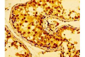 IHC image of ABIN7142604 diluted at 1:100 and staining in paraffin-embedded human testis tissue performed on a Leica BondTM system. (AZI2 antibody  (AA 258-376))