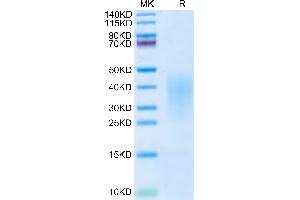 IL-13 Protein (AA 19-132) (His tag)