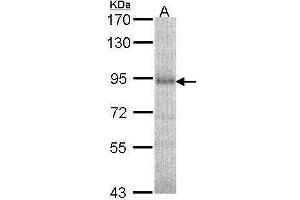 WB Image Sample (30 ug of whole cell lysate) A: A549 7. (DPP8 antibody)