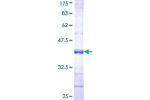 UGT1A6 Protein (AA 44-143) (GST tag)