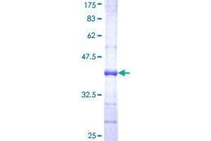 UGT1A6 Protein (AA 44-143) (GST tag)