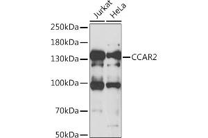 Western blot analysis of extracts of various cell lines, using CC antibody (ABIN6133528, ABIN6138034, ABIN6138035 and ABIN6222941) at 1:1000 dilution.