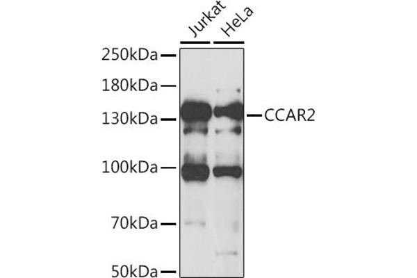CCAR2 Antikörper  (AA 654-923)