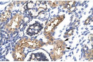 Human kidney; EHF antibody - N-terminal region in Human kidney cells using Immunohistochemistry