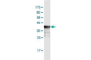 Western Blot detection against Immunogen (36. (PPM1F antibody  (AA 1-100))