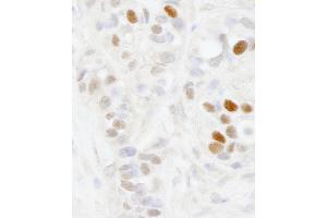 Immunohistochemistry (IHC) image for anti-Melanoma Antigen Family D, 2 (MAGED2) (AA 50-100) antibody (ABIN7448635) (MAGED2 antibody  (AA 50-100))