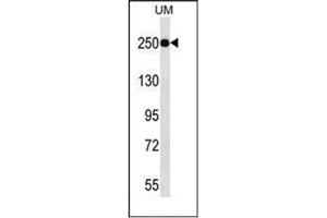 Western blot analysis of JARID1A Antibody (C-term) in UM cell line lysates (35ug/lane).