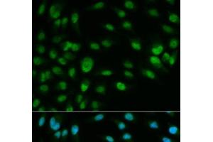 Immunofluorescence analysis of HeLa cells using MCM7 Polyclonal Antibody (MCM7 antibody)