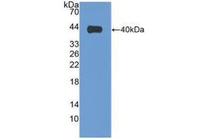 Western blot analysis of recombinant Human VIL1. (Villin 1 antibody  (AA 1-320))