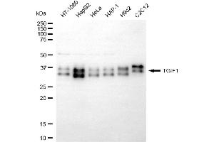 anti-TGFB-Induced Factor Homeobox 1 (TGIF1) antibody