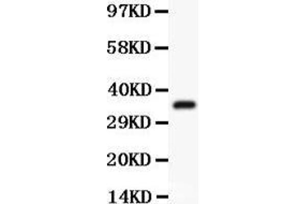 Desmin antibody  (AA 1-304)