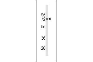 Western blot analysis of hPIP5K1G- (ABIN392596 and ABIN2842125) in Hela cell line lysates (35 μg/lane). (PIP5K1C antibody  (C-Term))