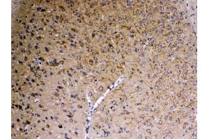 IHC analysis of SAP102 using anti-SAP102 antibody . (DLG3 antibody  (AA 749-817))