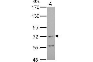 WB Image Sample (30 ug of whole cell lysate) A: U87-MG 7. (AChR alpha 4 (Center) antibody)