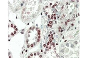 IHC staining of FFPE human kidney with PRAK antibody at 5ug/ml. (MAPKAP Kinase 5 antibody)