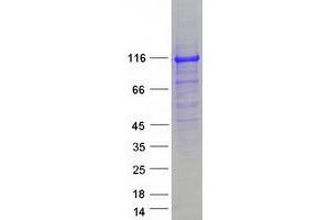 Western Blotting (WB) image for E3 ubiquitin-protein ligase NEDD4-like (NEDD4L) (Transcript Variant B) protein (Myc-DYKDDDDK Tag) (ABIN2727064)