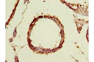 Immunohistochemistry of paraffin-embedded human testis tissue using ABIN7171606 at dilution of 1:100 (TBC1D19 antibody  (AA 1-300))
