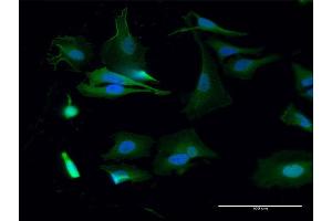 Immunofluorescence (IF) image for anti-Budding Uninhibited By Benzimidazoles 1 Homolog (Yeast) (BUB1) (AA 1-1085) antibody (ABIN513834)