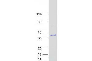 PGAM5 Protein (Transcript Variant 1) (Myc-DYKDDDDK Tag)