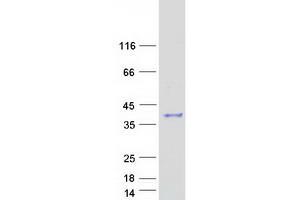 PGAM5 Protein (Transcript Variant 1) (Myc-DYKDDDDK Tag)