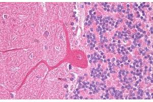 Anti-SLC38A1 antibody IHC staining of human brain, cerebellum, Purkinje. (SLC38A1 antibody  (AA 1-63))