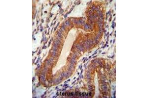 Immunohistochemistry (Paraffin-embedded Sections) (IHC (p)) image for anti-Chromosome 18 Open Reading Frame 10 (C18orf10) (AA 116-145), (Middle Region) antibody (ABIN950796)