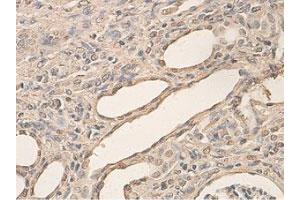 Immunohistochemical staining of formalin-fixed paraffin-embedded rat kidney tissue showing cytoplasmic and nuclear staining with AHR polyclonal antibody  at 1 : 200 dilution. (Aryl Hydrocarbon Receptor antibody  (N-Term))