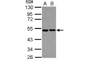 Western Blotting (WB) image for anti-Eukaryotic Translation Initiation Factor 2, Subunit 2 Beta, 38kDa (EIF2S2) (AA 1-216) antibody (ABIN1497973) (EIF2S2 antibody  (AA 1-216))