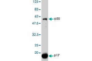 Detection of HIV-1 p17 and its p55 precursor proteins by Western blotting using the HIV-1 Gag p17 polyclonal antibody  . (HIV-1 p17 antibody)