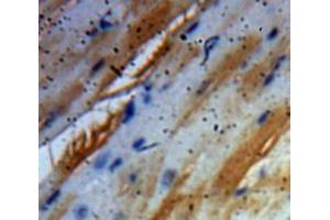 Used in DAB staining on fromalin fixed paraffin-embedded Heart tissue (BDNF antibody  (AA 129-247))