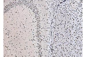 IHC analysis of DBC-1/CCAR2 using anti-DBC-1/CCAR2 antibody (ABIN7602235). (CCAR2 antibody  (AA 65-917))