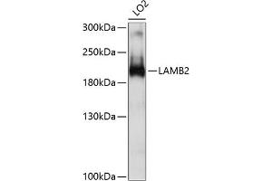 Western blot analysis of extracts of LO2 cells, using L antibody (ABIN6132095, ABIN6143070, ABIN6143071 and ABIN6214860) at 1:1000 dilution.