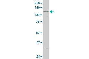 Image no. 3 for anti-ABL2 (ABL2) (AA 743-842) antibody (ABIN465946) (ABL2 antibody  (AA 743-842))