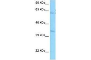 PPCS anticorps  (AA 60-109)