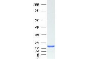 Validation with Western Blot