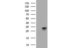 HEK293T cells were transfected with the pCMV6-ENTRY control (Left lane) or pCMV6-ENTRY UCK1 (Right lane) cDNA for 48 hrs and lysed. (UCK1 antibody)