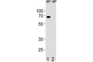 Western blot analysis of ETV5 antibody pre-incubated without (Lane 1) and with (2) blocking peptide in SW480 lysate (ETV5 antibody  (AA 8-36))