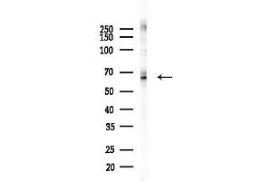 Western blot analysis of lysates from COLO205 cells(heat-shock,45 min treatment), using SHP1 Antibody at 1/1000 dilution.
