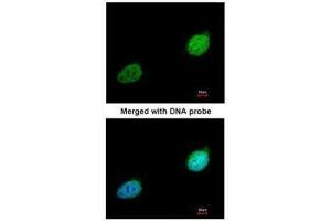 ICC/IF Image Immunofluorescence analysis of paraformaldehyde-fixed HeLa, using XPA, antibody at 1:200 dilution. (XPA antibody  (Center))