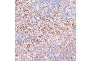 Immunohistochemistry (IHC) image for anti-GTPase Activating Protein (SH3 Domain) Binding Protein 1 (G3BP1) (AA 131-330) antibody (ABIN7267528)