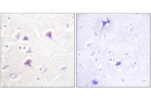 Immunohistochemistry analysis of paraffin-embedded human brain tissue, using HER4 (Ab-1284) Antibody. (ERBB4 antibody  (AA 1250-1299))
