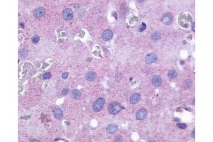 Anti-PTGFR antibody IHC of human ovary. (PTGFR antibody  (Cytoplasmic Domain))