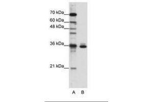 Image no. 3 for anti-Musashi Homolog 2 (MSI2) (AA 37-86) antibody (ABIN203056) (MSI2 antibody  (AA 37-86))