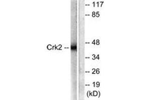 Western blot analysis of extracts from COS7 cells, using CrkII (Ab-221) Antibody. (Crk antibody  (AA 187-236))