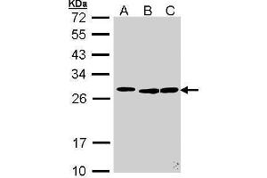 WB Image Sample (30 ug of whole cell lysate) A: 293T B: Molt-4 , C: Raji 12% SDS PAGE antibody diluted at 1:500 (SFRS9 antibody  (Center))