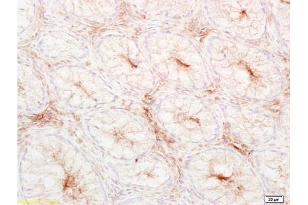 LDL antibody