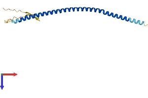 Coiled-Coil Domain Containing 182 (CCDC182) (AA 1-153) protein (His tag)