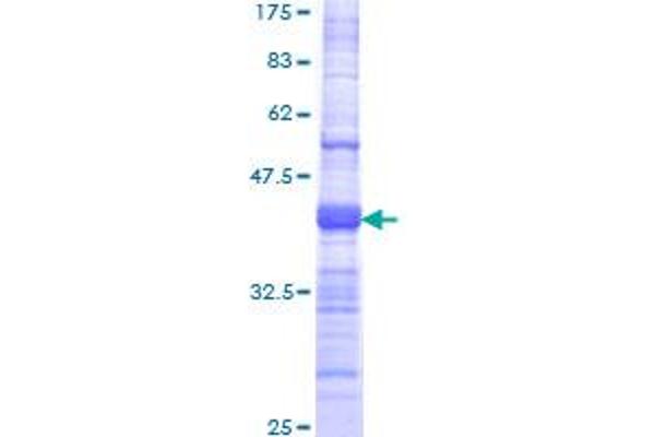 TMPRSS15 Protein (AA 361-470) (GST tag)
